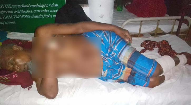 ঝিনাইদহে ব্যবসায়ীর পায়ের রগ কর্তন